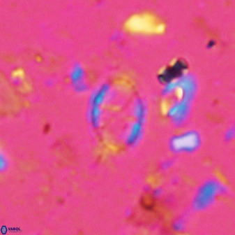 Corollithion msakyae 36152