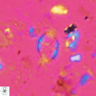 Corollithion msakyae 36152