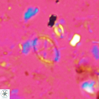 Corollithion msakyae 36154
