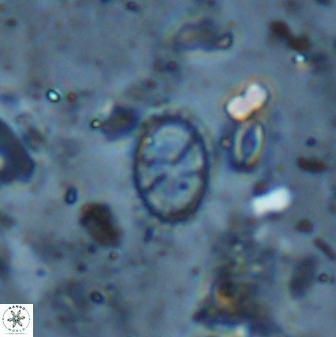 Corollithion msakyae 36157