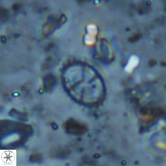Stoverius msakyae 36159