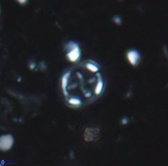 Corollithion signum 971