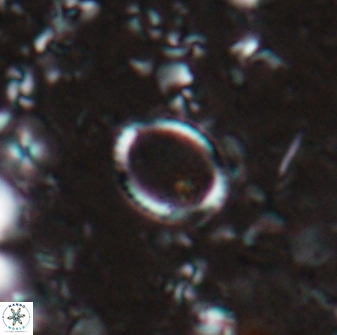 Coronocyclus baileyi 22817