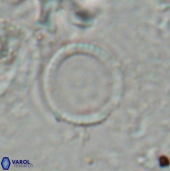 Coronocyclus nitescens 27154