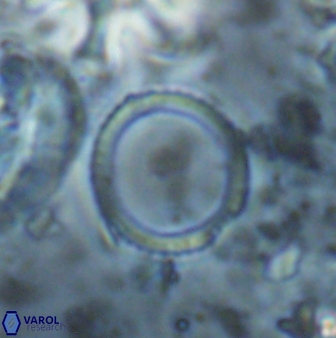 Coronocyclus nitescens 27153