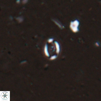 Coronosphaera mediterranea 26500