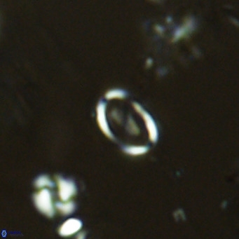 Coronosphaera mediterranea VR 05962
