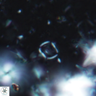 Coronosphaera sp 749