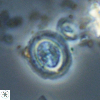 Clausicoccus cribellus VR 24205
