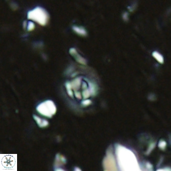 Clausicoccus obrutus VR 02695