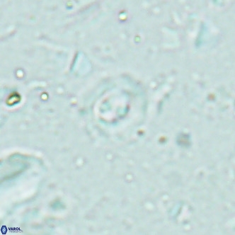 Clausicoccus obrutus VR 02699