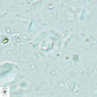 Clausicoccus obrutus VR 02699
