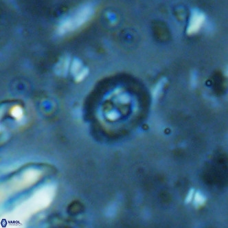 Clausicoccus obrutus VR 02704