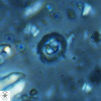Clausicoccus obrutus VR 02704
