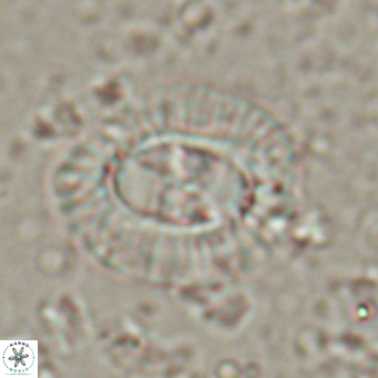 Clausicoccus norrisii VR 025360