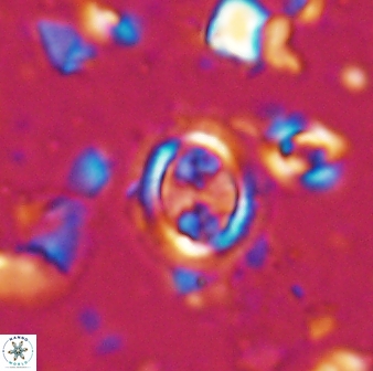 Clausicoccus singularis 27798
