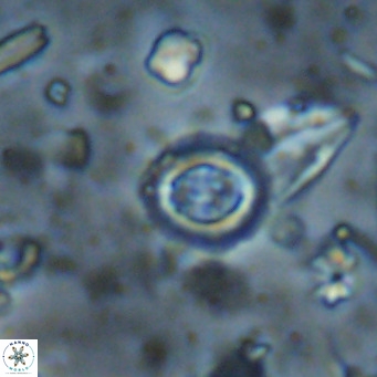 Clausicoccus singularis VR 026984
