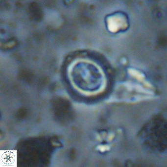 Clausicoccus singularis VR 026985