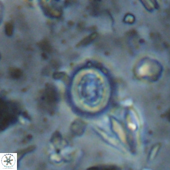 Clausicoccus singularis VR 026987