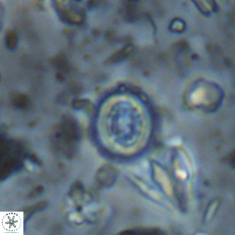 Clausicoccus singularis VR 026988