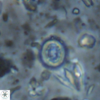 Clausicoccus singularis VR 026990