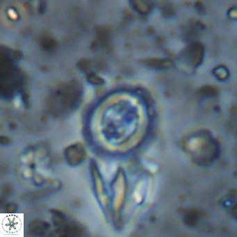 Clausicoccus singularis VR 026991
