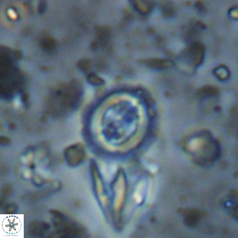 Clausicoccus singularis VR 026992
