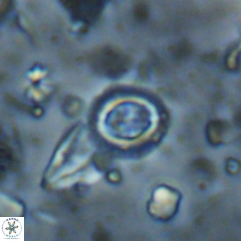 Clausicoccus singularis VR 026993
