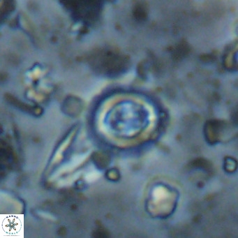 Clausicoccus singularis VR 026995