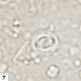 Clausicoccus singularis VR 026996