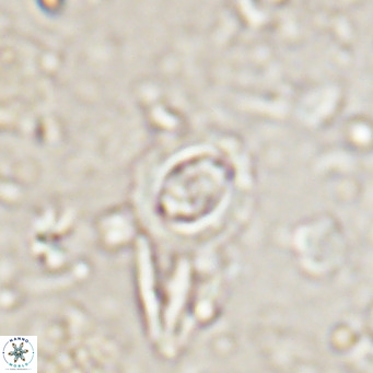 Clausicoccus singularis VR 026997