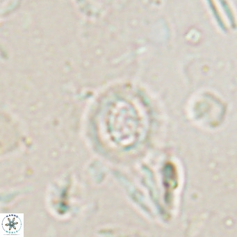 Clausicoccus singularis VR 027000