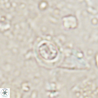 Clausicoccus singularis VR 027002