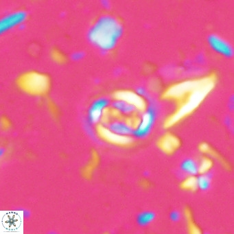 Clausicoccus singularis VR 027003