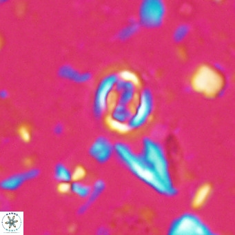 Clausicoccus singularis VR 027010