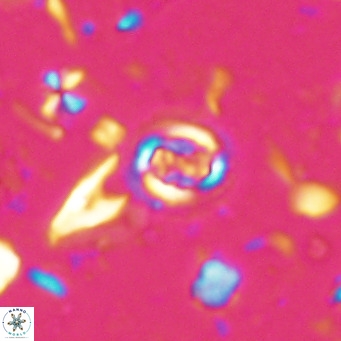 Clausicoccus singularis VR 027014