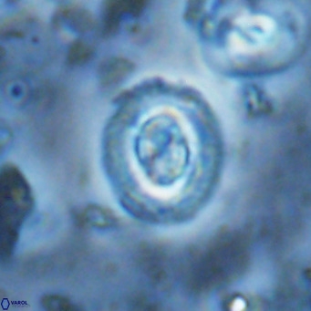 Clausicoccus singularis VR 17102