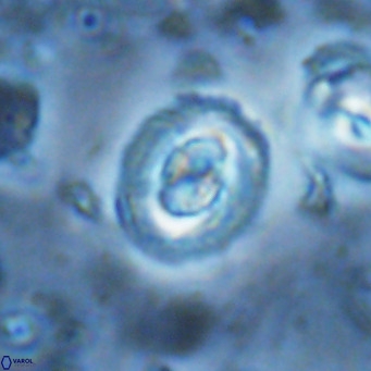 Clausicoccus singularis VR 17103