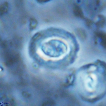 Clausicoccus singularis VR 17105