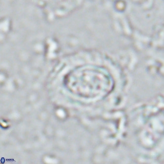 Clausicoccus singularis VR 17108