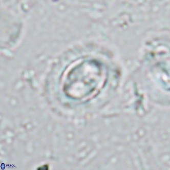 Clausicoccus singularis VR 17109