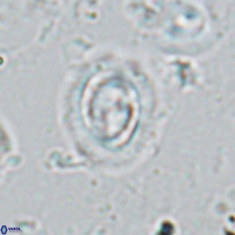 Clausicoccus singularis VR 17111