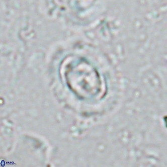 Clausicoccus singularis VR 17114