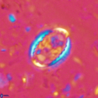 Clausicoccus vanheckiae VR 03113