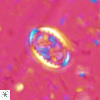 Clausicoccus vanheckiae VR 03119