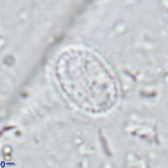 Clausicoccus vanheckiae VR 03120