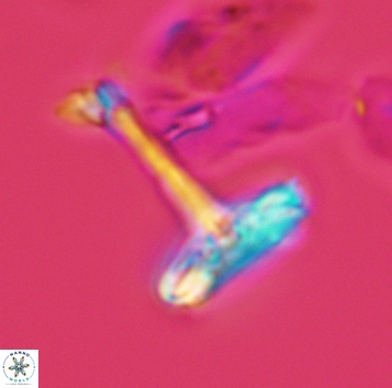Cretarhabdaceae sp 3720