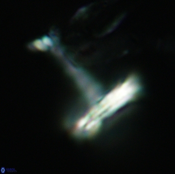 Cretarhabdaceae sp 3722