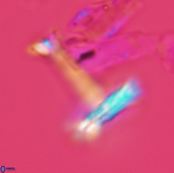 Cretarhabdaceae sp 3723