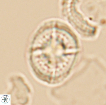 Cretarhabdus conicus 10096